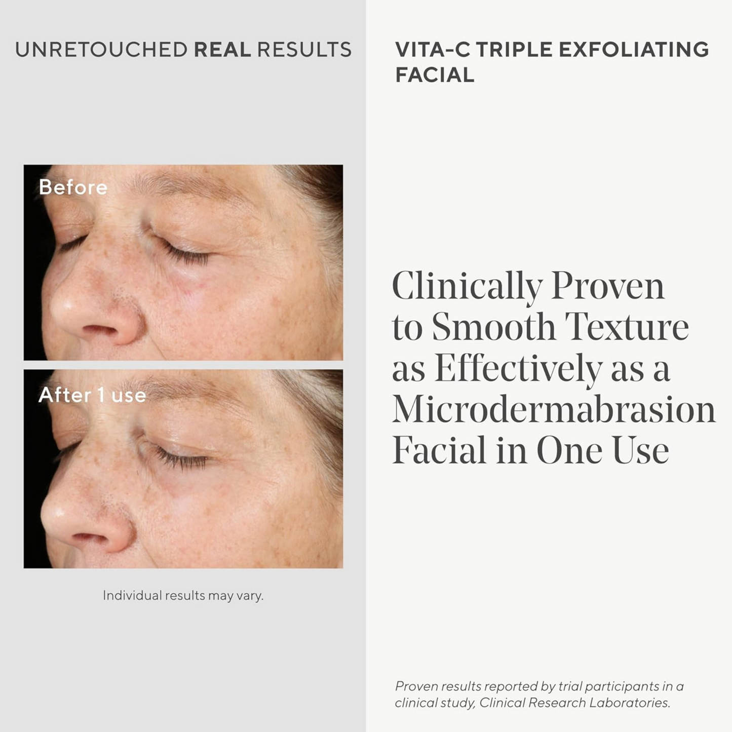MURAD 80ML ES VITA-C TRIPLE RESURFACING Peeling-Gesichtsbehandlung