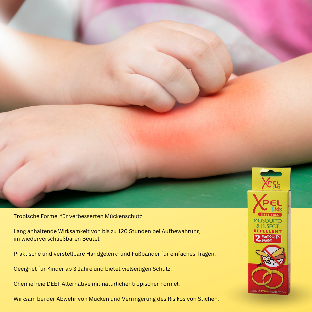 Xpel Mücken- und Insektenschutz Set für Erwachsene & Kinder - DEET-frei - Chemiefreie Armbänder & Spray mit natürlicher tropischer Formel